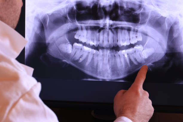 Professional Emergency Dentist in WI